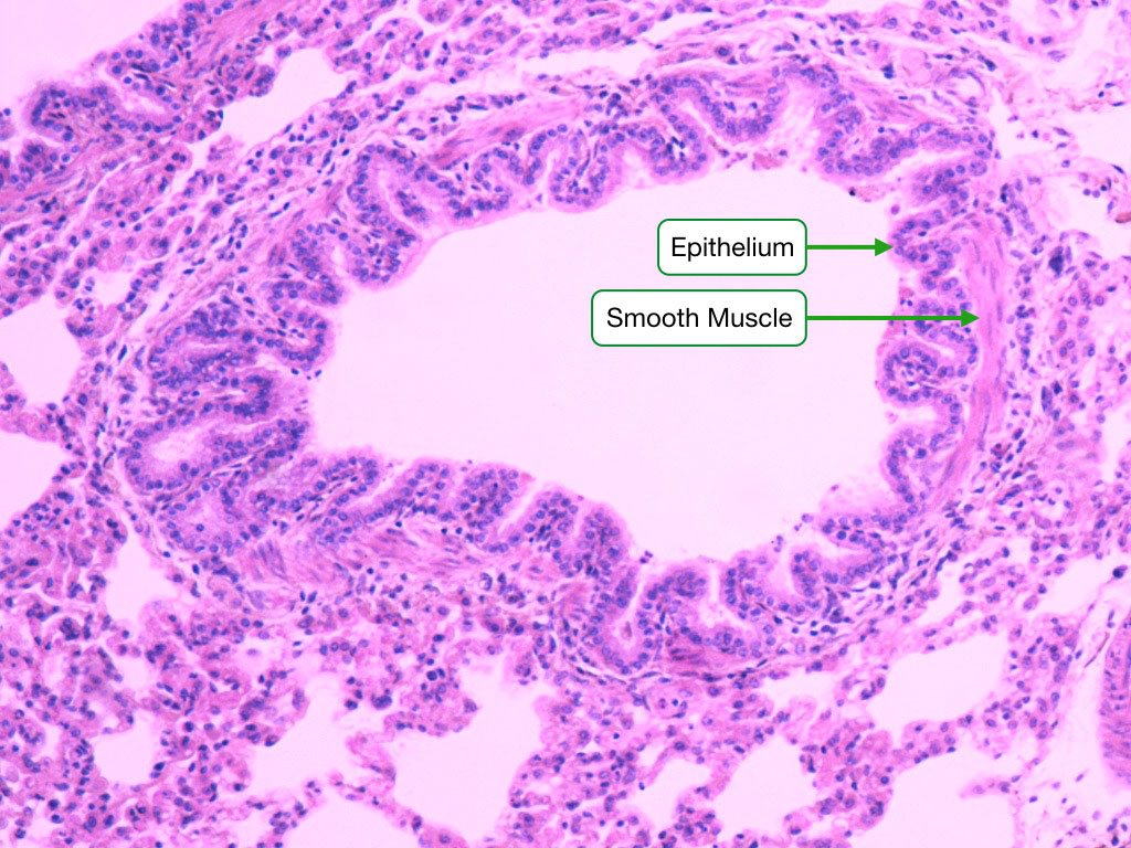 Bronchiole histology showing simple columnar epithelium and smooth muscle