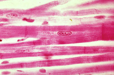 Cardiac muscle histology showing branching fibers with central nuclei and intercalated discs