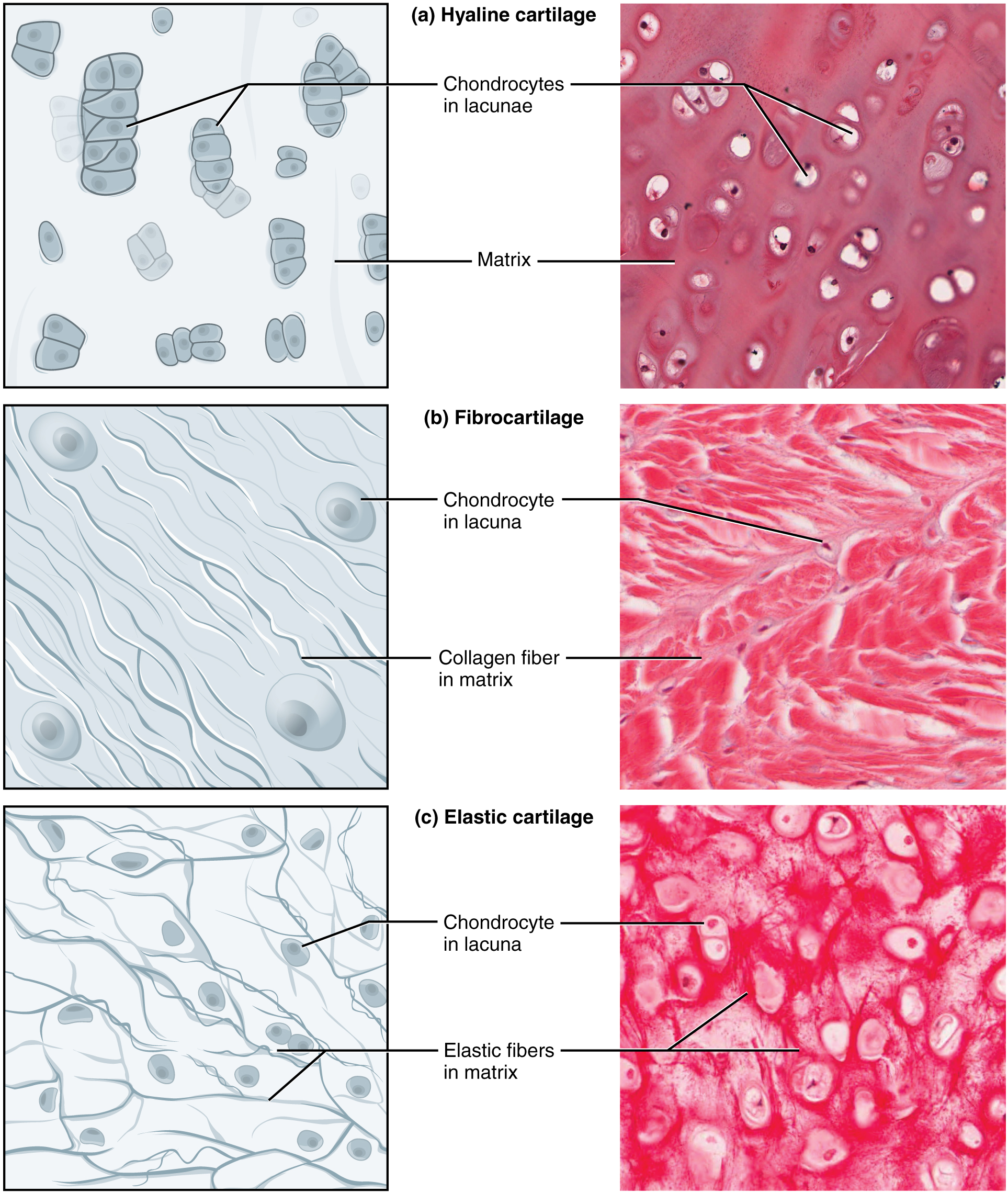 Comparison of hyaline, elastic, and fibrocartilage showing their distinct histological features and extracellular matrix composition