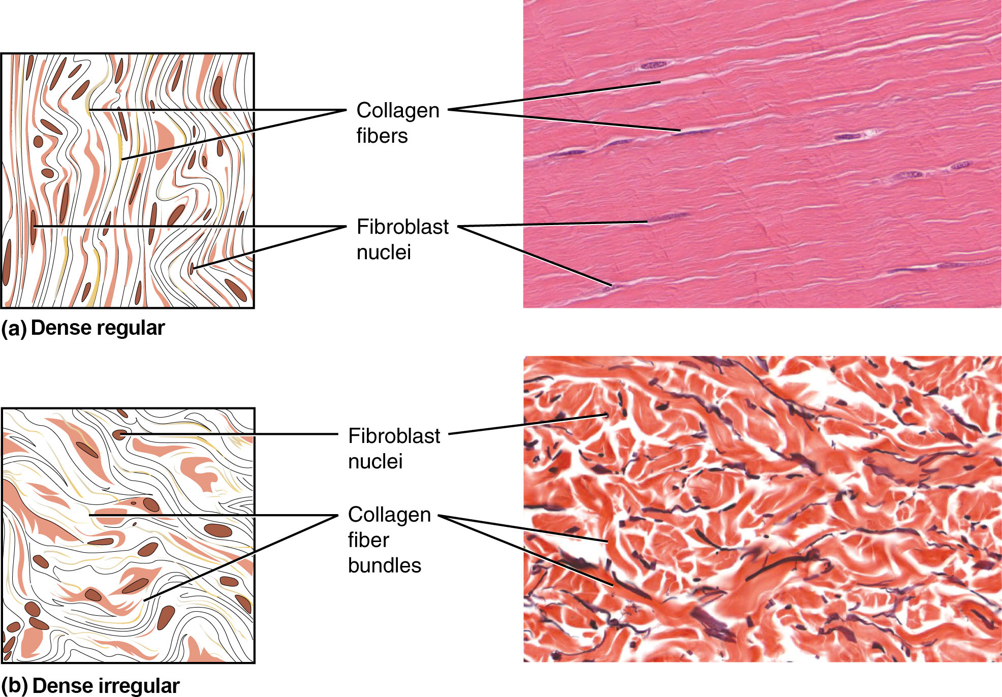 Comparison of dense regular and dense irregular connective tissue histology