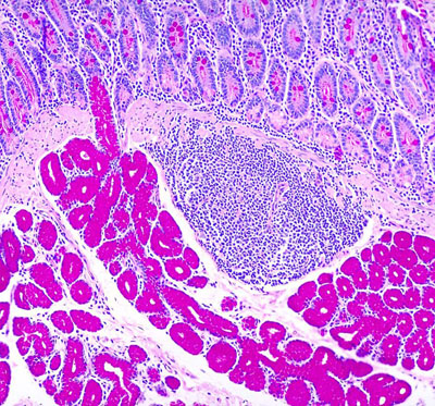 Duodenum histology showing Brunner glands in submucosa