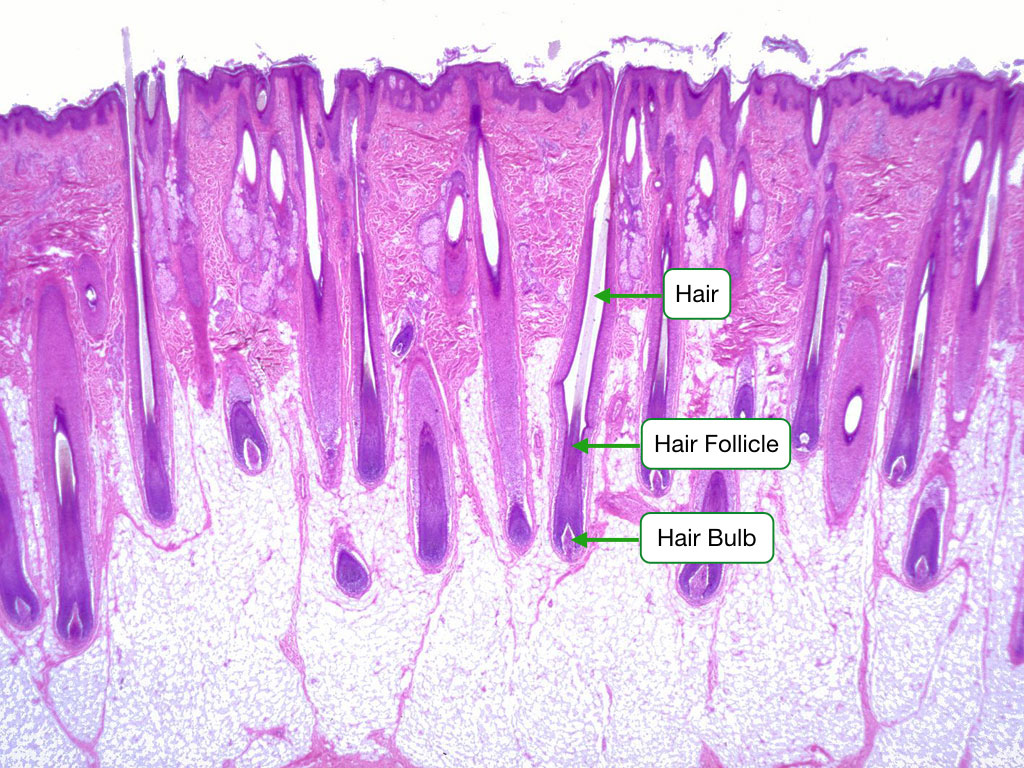 Hair follicle histology showing dermal papilla, hair matrix, and sebaceous gland