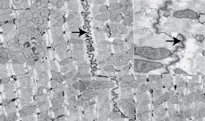Intercalated discs of cardiac muscle at high magnification