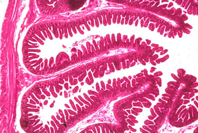 Jejunum histology showing villi, crypts of Lieberkuhn, and goblet cells