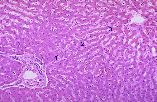 Liver histology showing hepatic lobule with central vein and portal triads