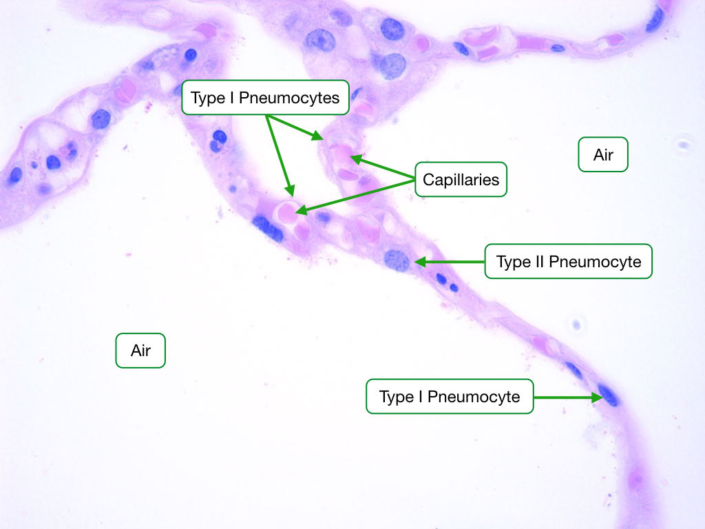 Lung alveoli histology showing type I and type II pneumocytes