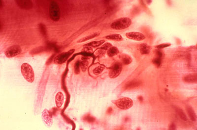 Neuromuscular junction histology showing motor end plate