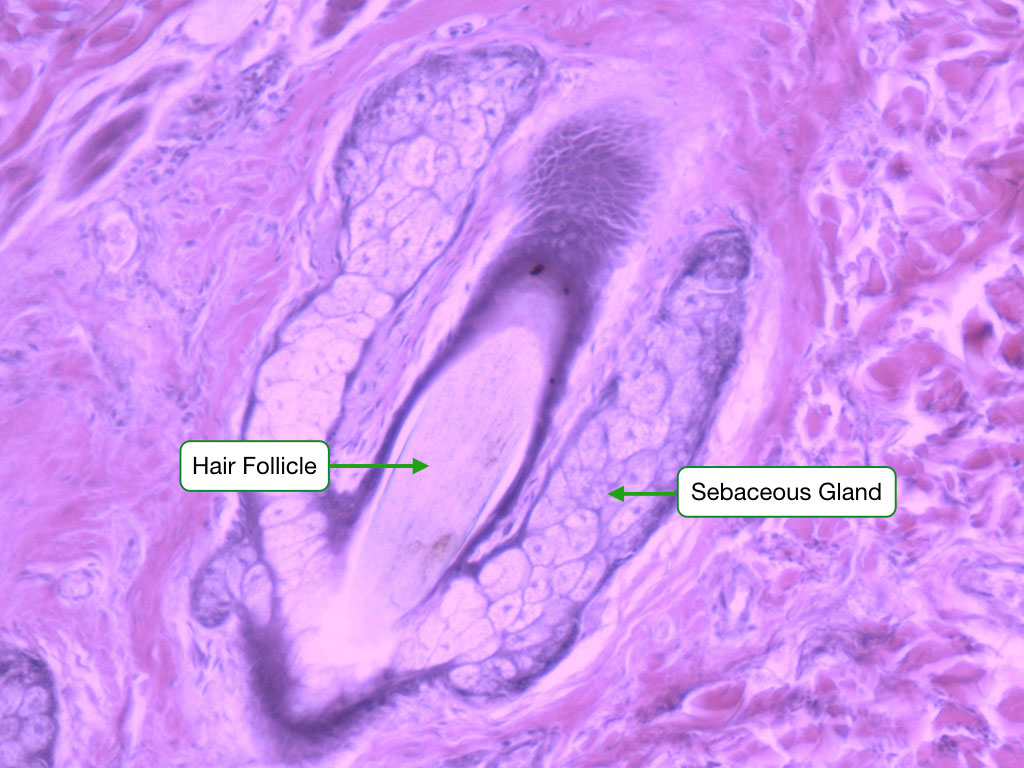 Sebaceous gland histology showing holocrine secretion