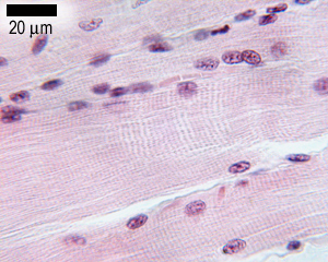 Skeletal muscle longitudinal section showing striations and peripheral nuclei