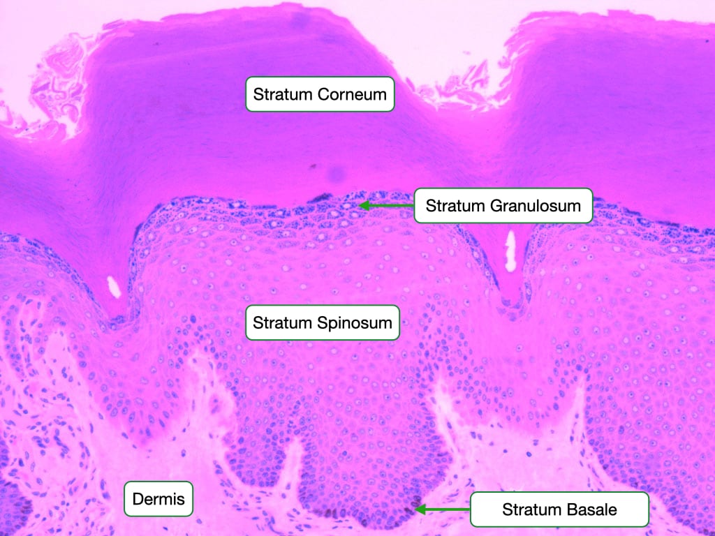 Epidermal layers of thick skin showing stratum basale, spinosum, granulosum, and corneum