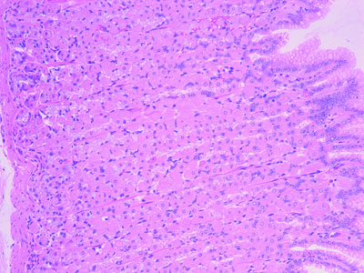Stomach body histology showing gastric pits and glands with parietal and chief cells