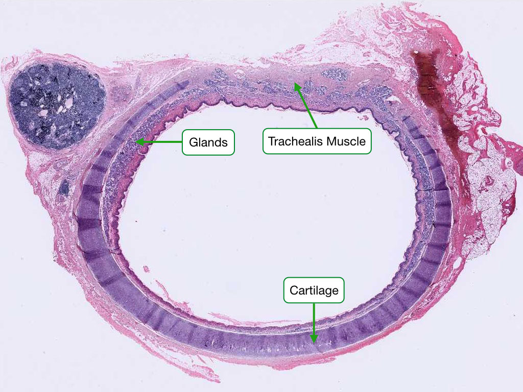 Trachea histology showing pseudostratified ciliated epithelium and hyaline cartilage rings
