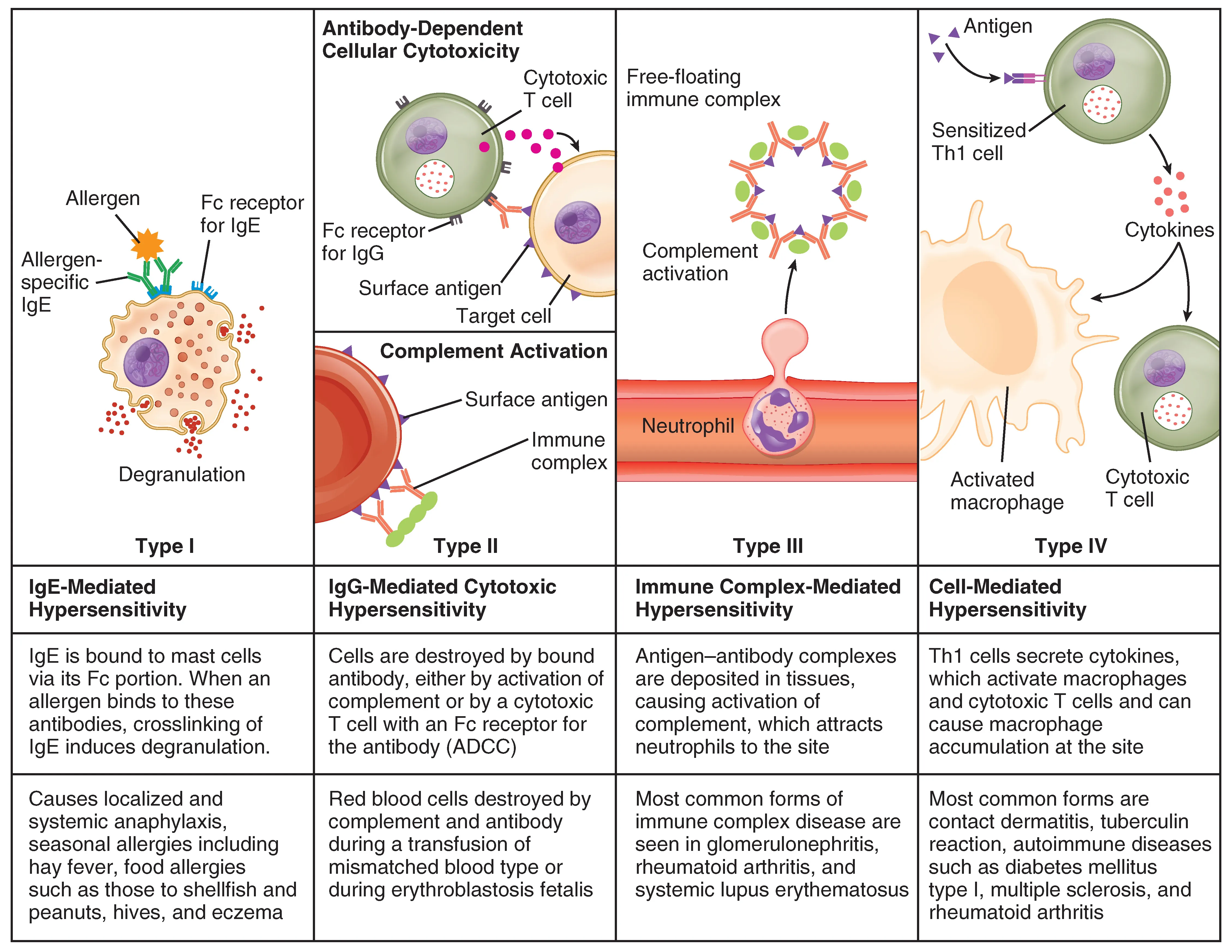 Comprehensive overview of all four types of hypersensitivity reactions with mechanisms and examples