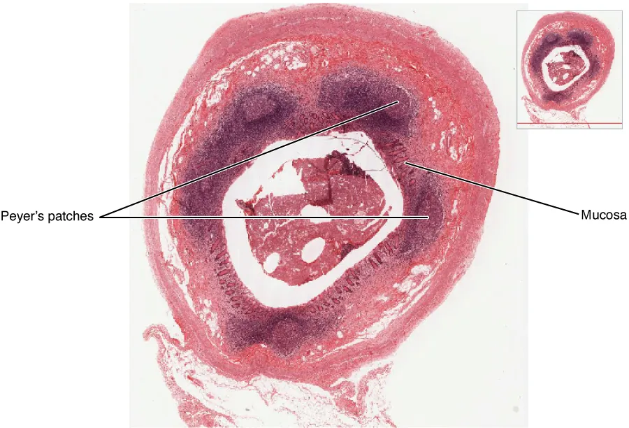 Mucosa-associated lymphoid tissue (MALT) showing Peyer patches and M cells