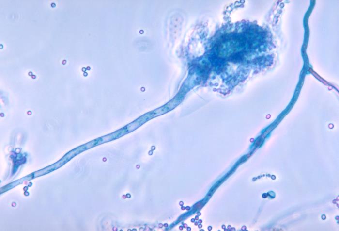Aspergillus fumigatus septate hyphae branching at 45-degree angles on histology