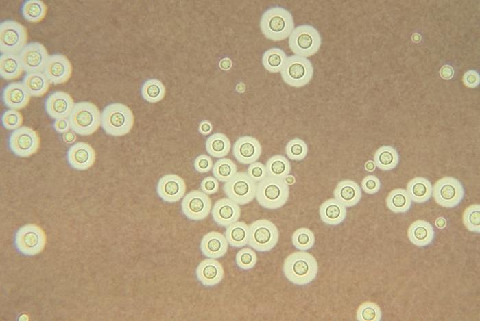 India ink preparation showing Cryptococcus neoformans with clear capsular halo