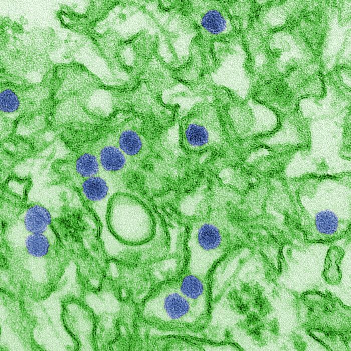 Gram stain results showing purple Gram-positive and pink Gram-negative bacteria