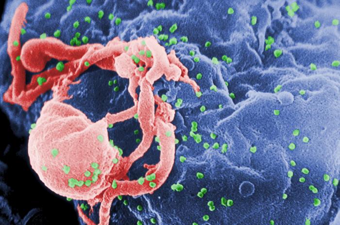 Diagram of HIV virion structure showing gp120, gp41, p24 capsid, and reverse transcriptase