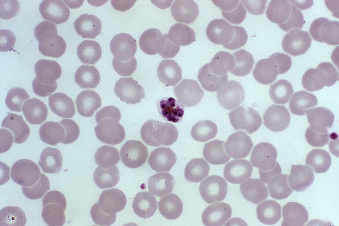 Thin blood smear showing Plasmodium falciparum ring forms within red blood cells