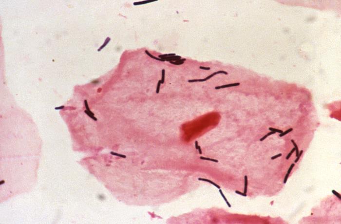 Pseudomonas aeruginosa culture showing characteristic blue-green pigment production