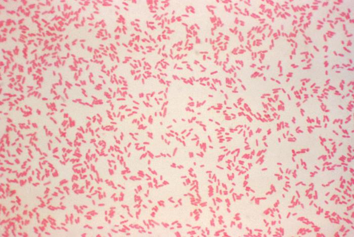Gram stain of Streptococcus pneumoniae showing lancet-shaped Gram-positive diplococci