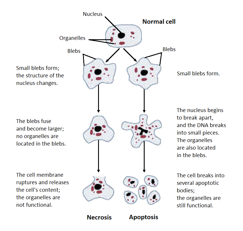 Overview of cell injury pathways leading to necrosis and apoptosis