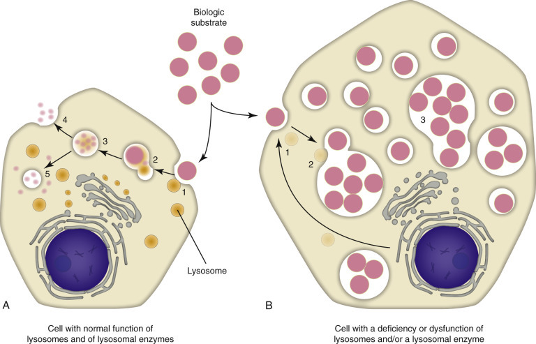Overview of lysosomal storage diseases and enzyme deficiency pathways