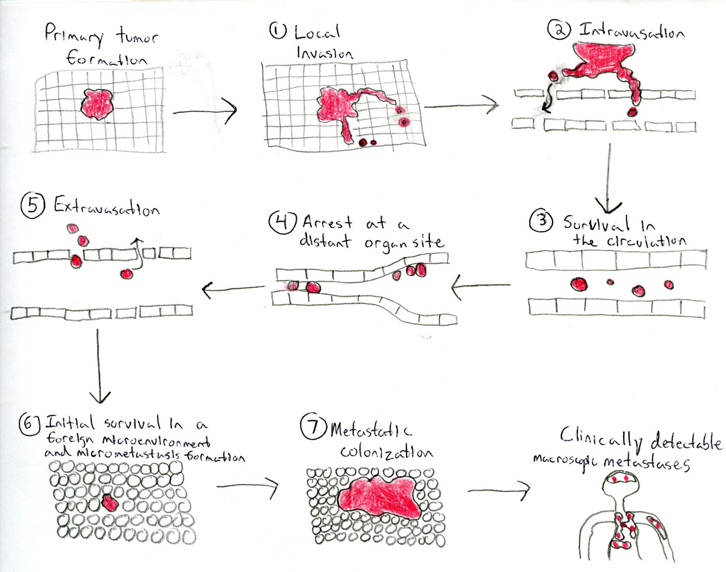 The invasion-metastasis cascade showing steps from primary tumor to distant colonization