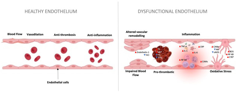 Effects of pulmonary embolism on vascular endothelium