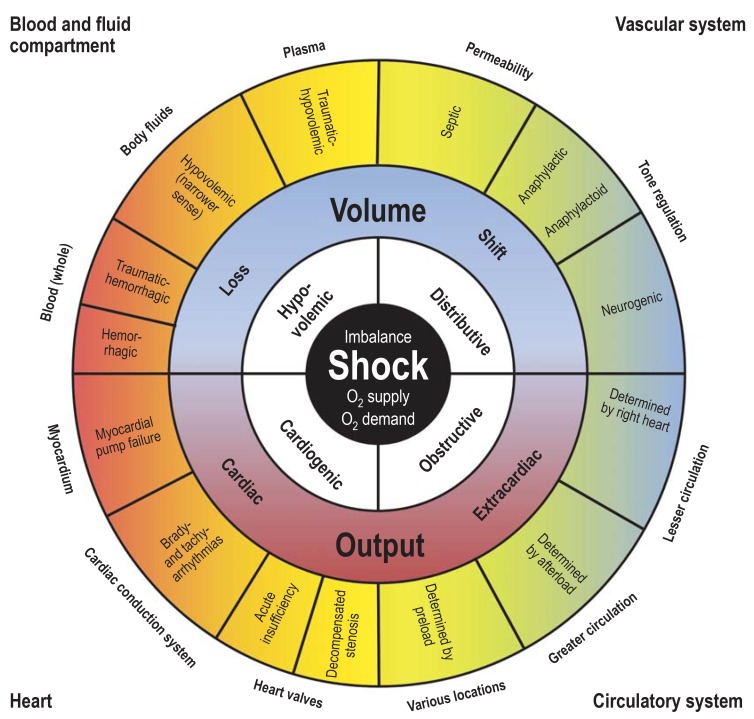 Classification of the four major types of shock