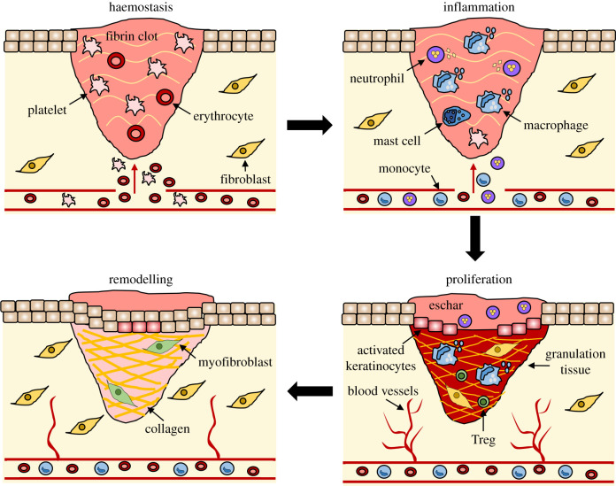 Stages of wound repair including hemostasis, inflammation, proliferation, and remodeling