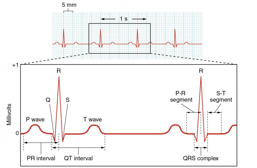 Normal ECG tracing showing P wave, QRS complex, T wave, PR interval, QT interval, and ST segment