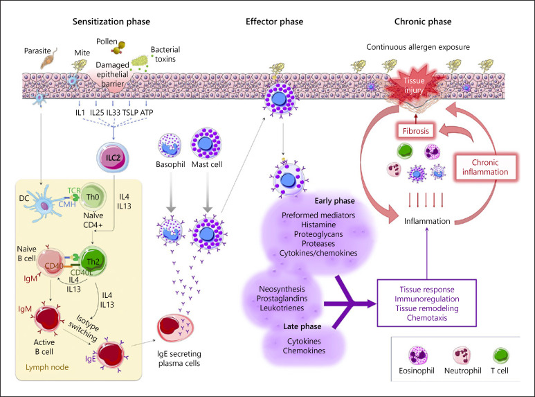 Diagram showing mechanisms of allergic inflammation including Th2 cell differentiation and cytokine pathways