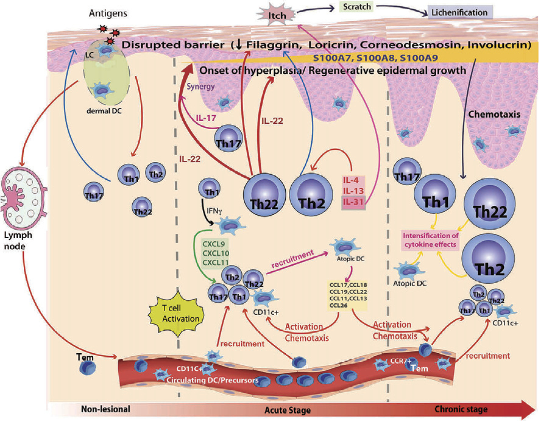 Diagram of immunologic pathways in atopic dermatitis showing skin barrier dysfunction, Th2 inflammation, and therapeutic targets