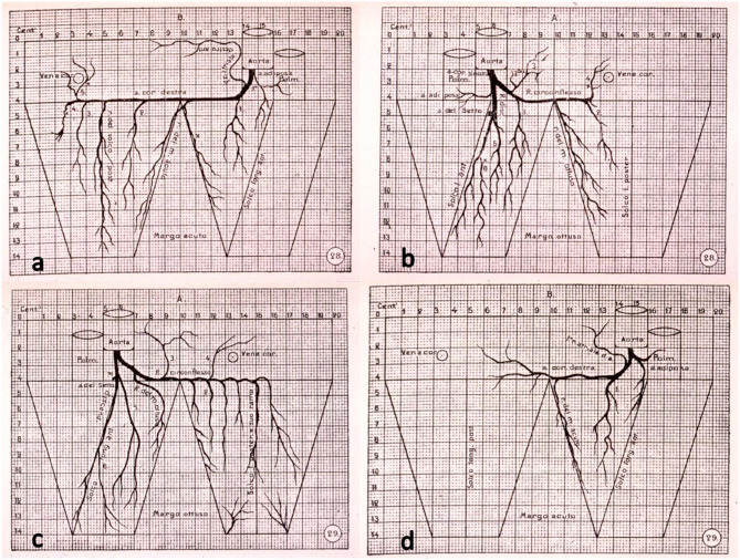 Historical anatomical drawings showing right and left coronary artery dominant patterns