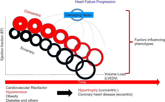 Cardiac remodeling patterns showing eccentric and concentric hypertrophy