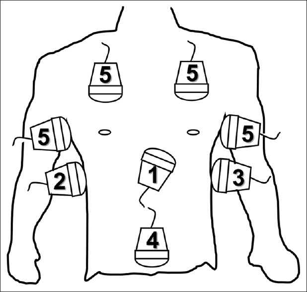 FAST exam probe positions and ultrasound windows including RUQ, LUQ, suprapubic, and subxiphoid views