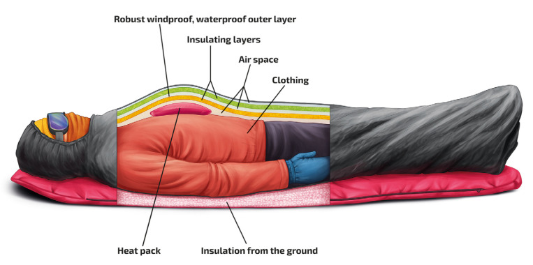 Hypothermia staging system showing clinical signs, ECG findings, and treatment approach at each temperature range