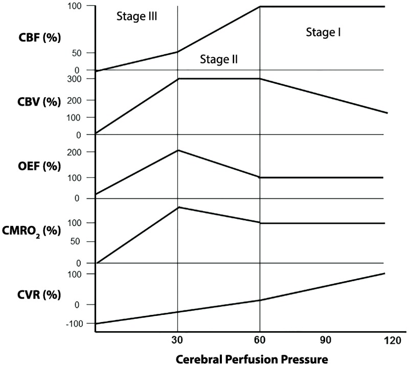 CT and CT angiography showing middle cerebral artery occlusion with hyperdense vessel sign and loss of gray-white differentiation