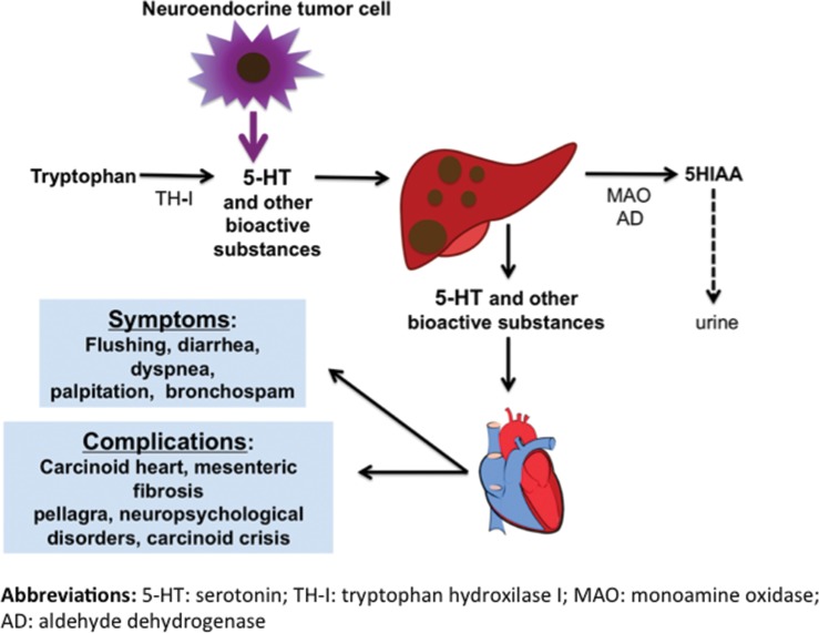 Summary diagram of carcinoid syndrome pathophysiology showing serotonin production, hepatic metastases, and systemic effects
