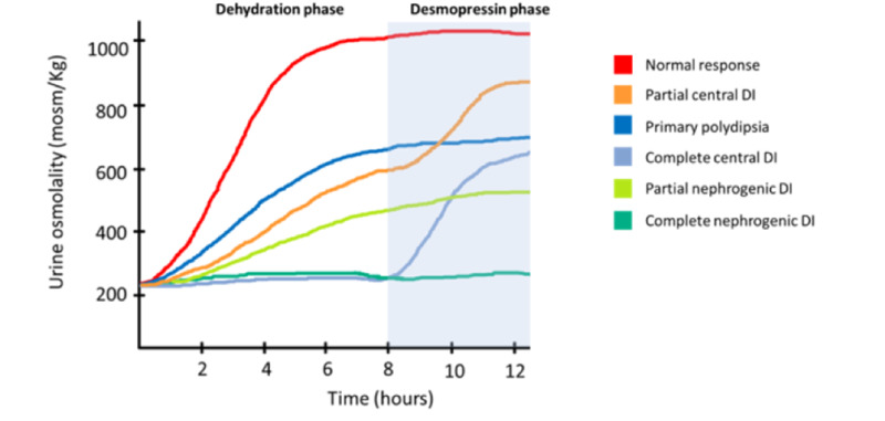 Graph showing water deprivation test results for central DI, nephrogenic DI, and primary polydipsia with urine osmolality response curves