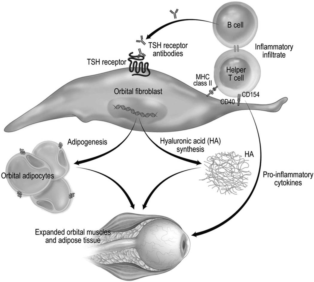 Immunopathogenesis diagram of Graves ophthalmopathy showing TSH receptor antibodies activating orbital fibroblasts