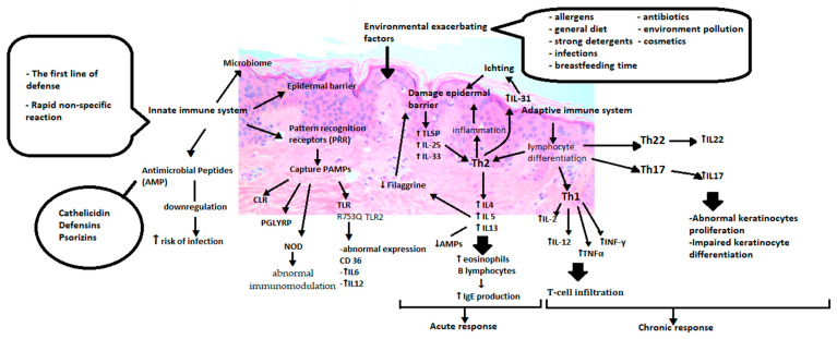 Diagram of immunological abnormalities in atopic dermatitis showing T-helper cell pathways, cytokine signaling, and barrier dysfunction