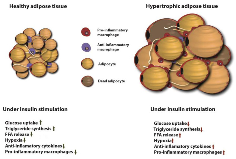 Diagram comparing insulin effects on healthy versus hypertrophic adipose tissue in type 2 diabetes