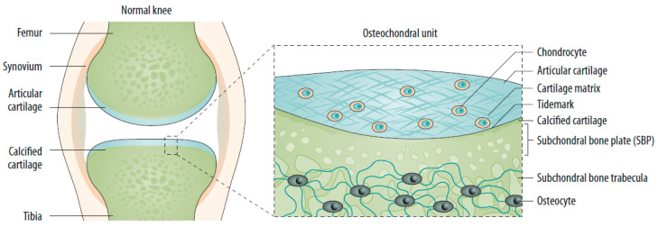 Diagram of normal knee joint anatomy showing articular cartilage, subchondral bone, synovial lining, and menisci