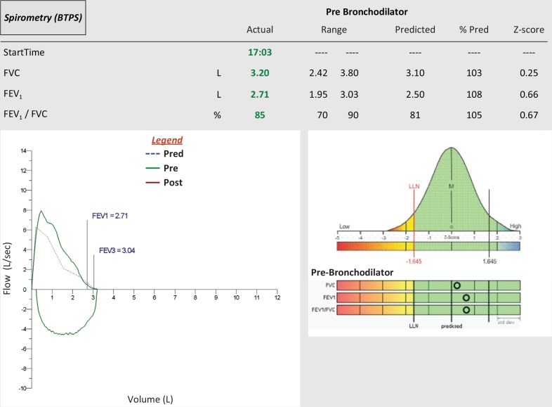 Normal spirometry flow-volume loop showing expected flows and volumes within normal range