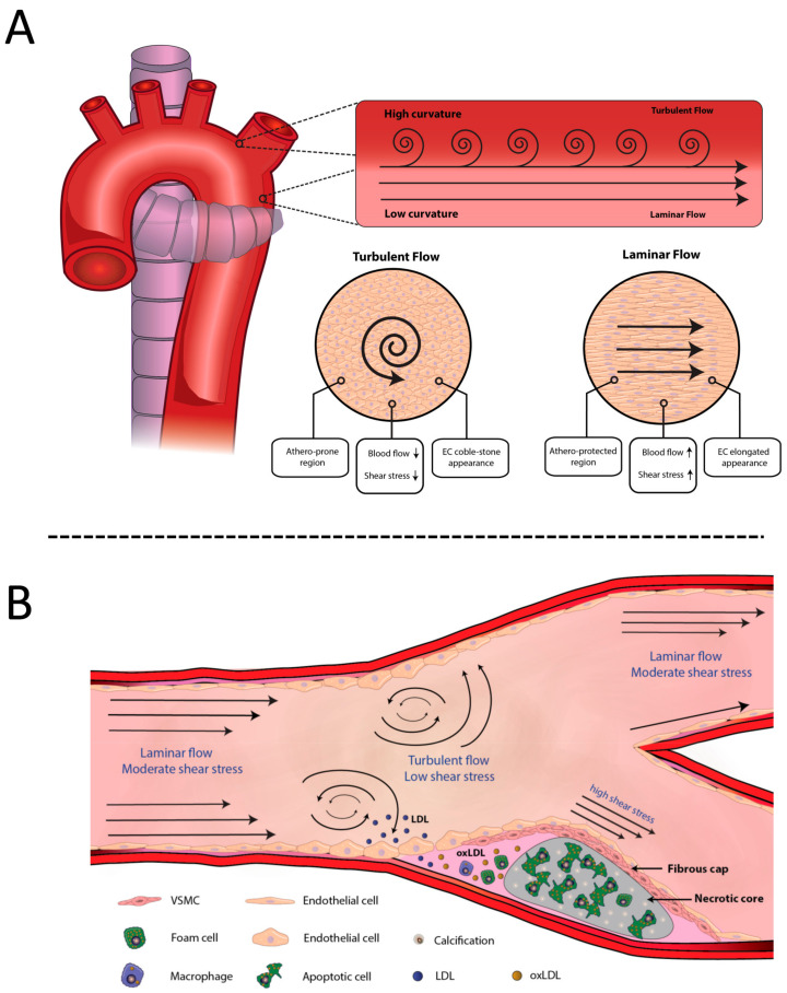 Diagram showing vascular flow patterns and wall shear stress at arterial bifurcations related to atherosclerosis development