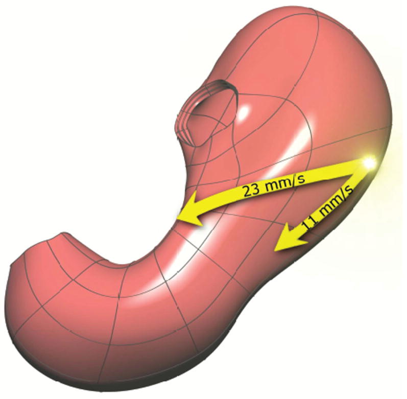 Diagram showing gastric slow wave propagation from the pacemaker region through the stomach