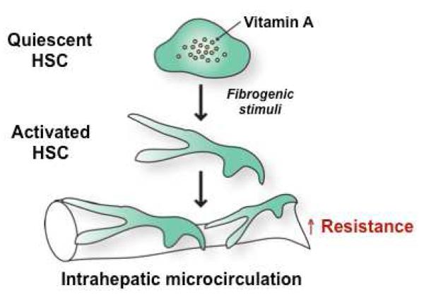 Diagram showing hepatic stellate cell activation from quiescent vitamin A storing cells to contractile myofibroblasts causing increased intrahepatic resistance