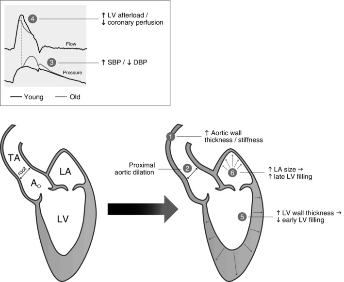 Diagram showing age-related changes in cardiac structure including left ventricular wall thickening, arterial stiffening, and diastolic dysfunction
